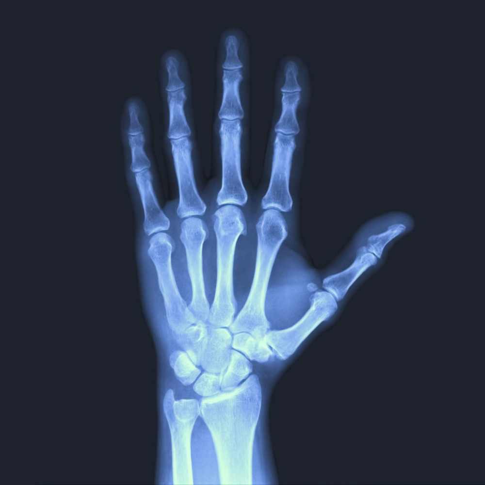 NDT X-Ray Film Recycling- NDT X-Ray Film Recycling