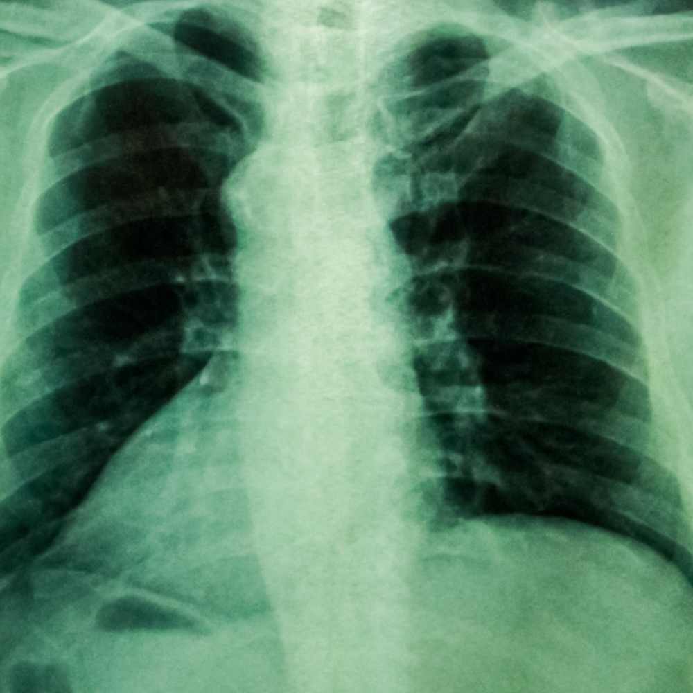 NDT X-Ray Film Recycling, NDT X-Ray Film Recycling