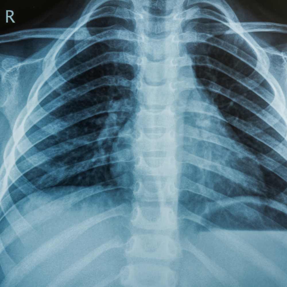 NDT X-Ray Film Recycling Industrial
