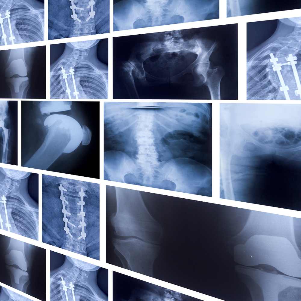 NDT X-Ray Film Recycling.. NDT X-Ray Film Recycling