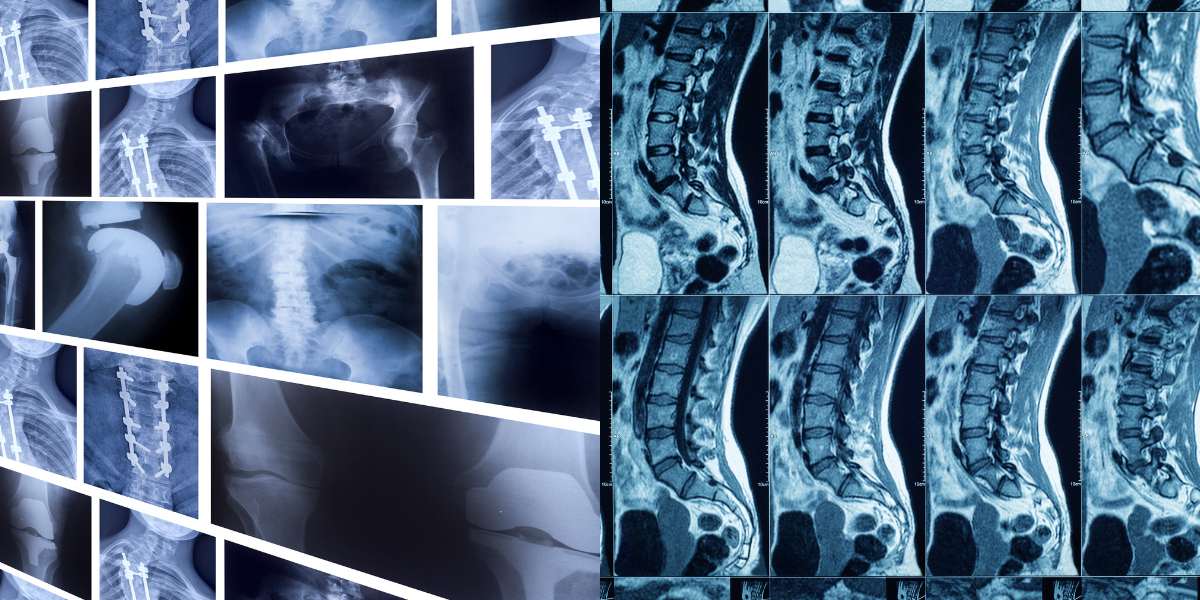 Medical and dental X-ray film recycling services