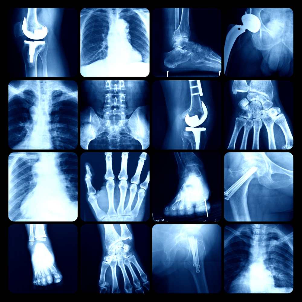 Medical X-Ray Film Recycling Services